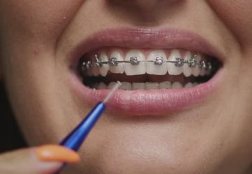Pediatric Dental Care